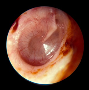 https://www.pbsfm.org.au/sites/default/files/images/Joel Spring, ‘Hearing, Loss’, 2018.jpg https://www.pbsfm.org.au/sites/default/files/images/Joel Spring, ‘Hearing, Loss’, 2018.jpg